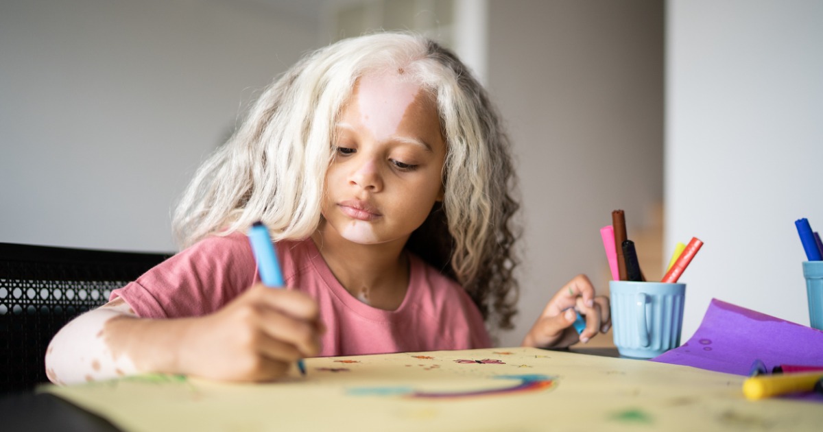 Girl with piebaldism drawing