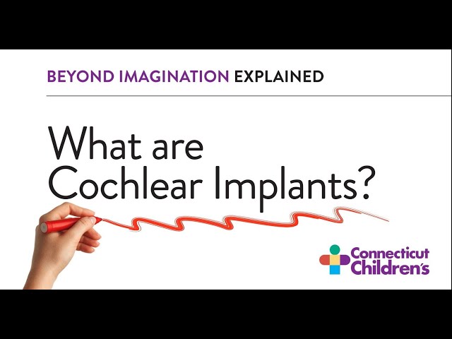 What are Cochlear Implants?