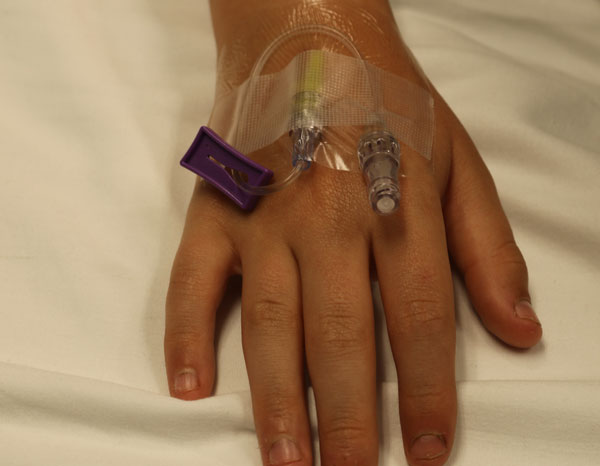 patients hand