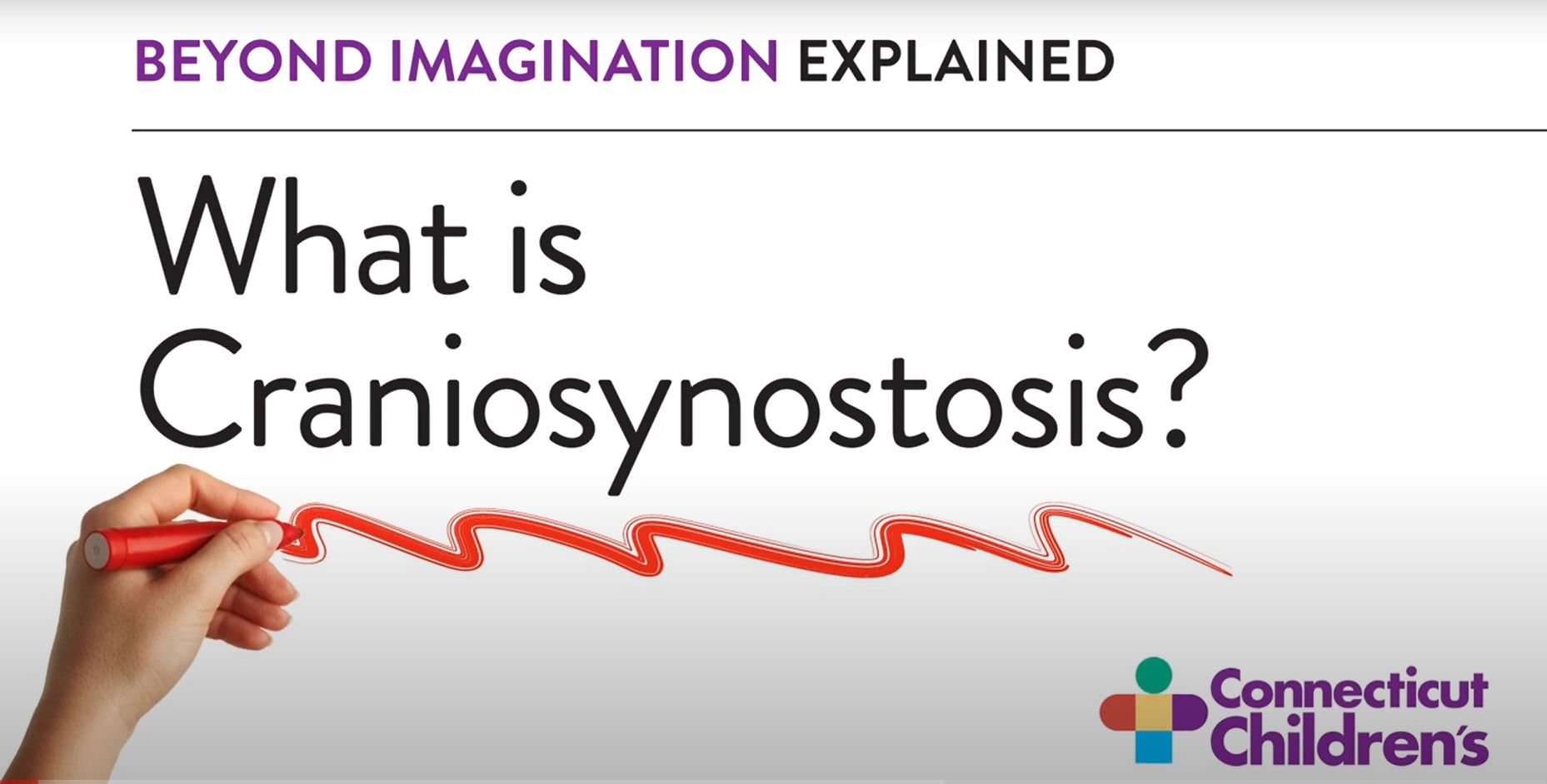 Beyond Imagination Explained - What is Craniosynostosis? - Picture of video