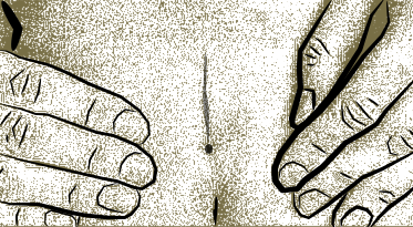 Medical illustration of coccygeal pit