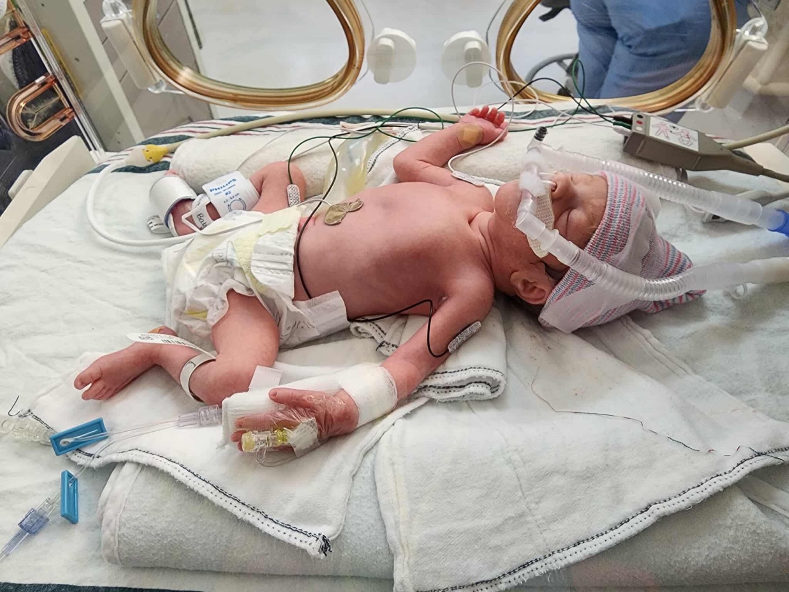 Family submitted fetal care patient story photos.