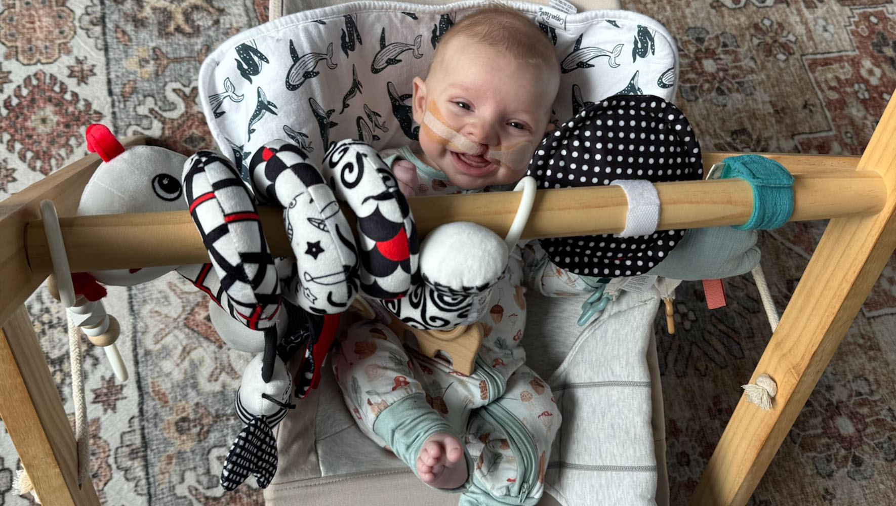 Craniofacial patient Tatum