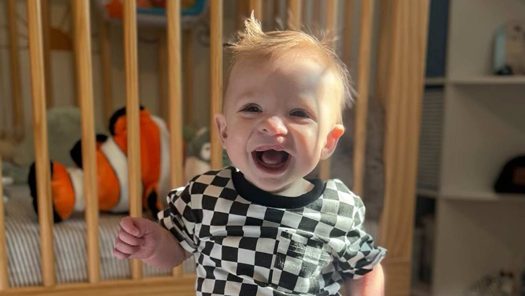 Craniofacial patient Tatum
