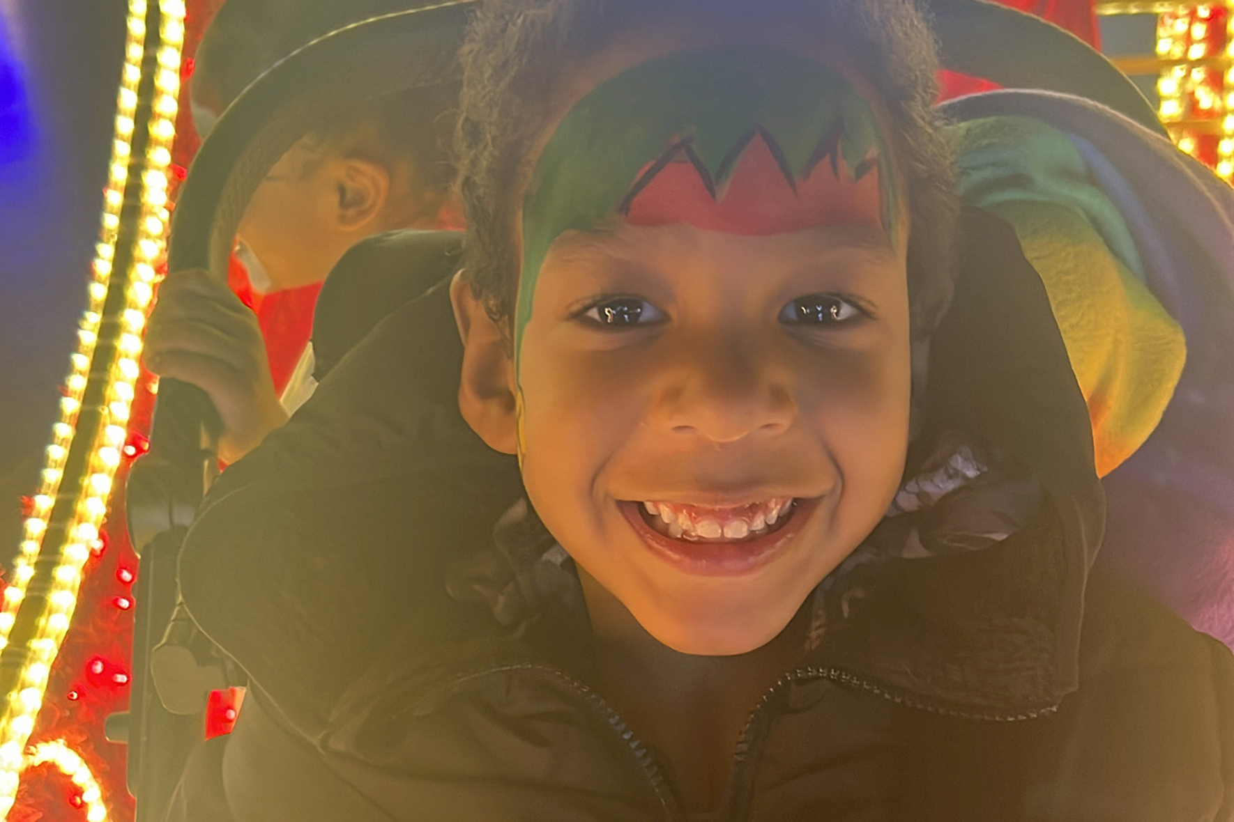 Patient family submitted photos for Adonis