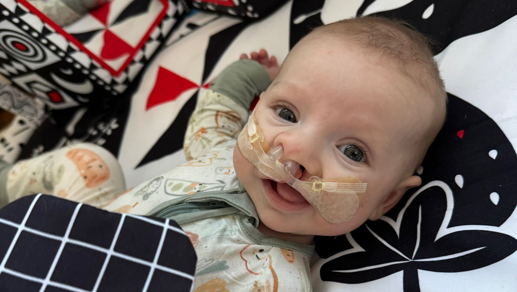 Craniofacial patient Tatum