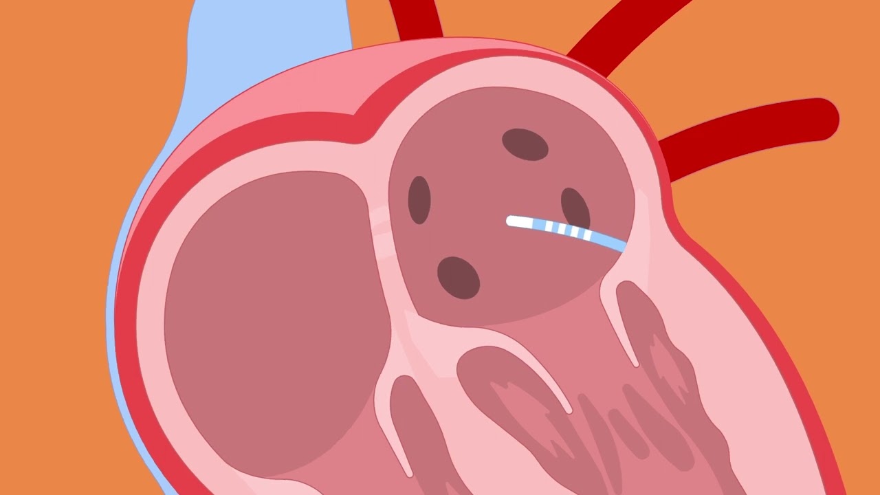 Video thumbnail image