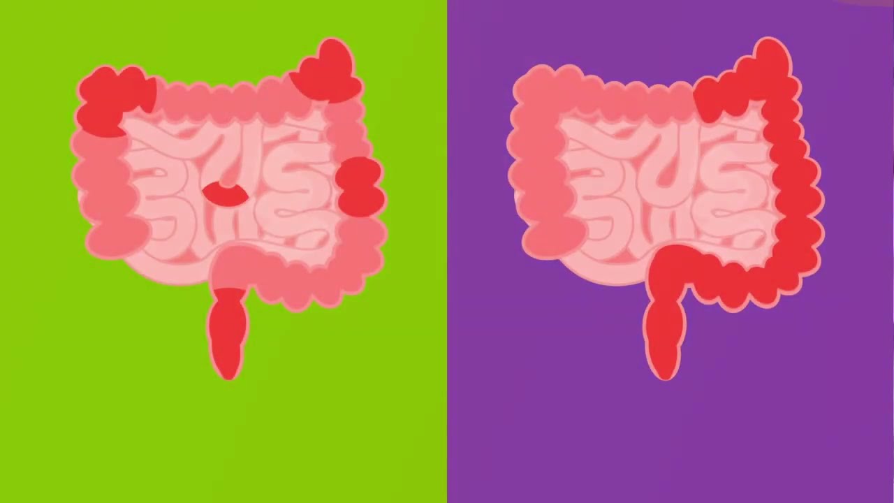 Video thumbnail image