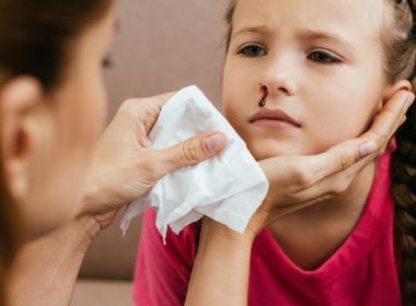 A young girl with a nose bleed
