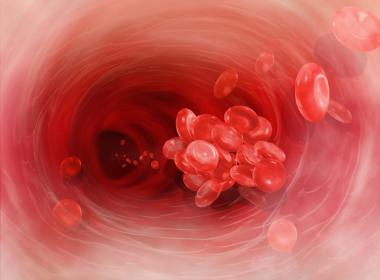 Blood clot illustration in artery. How to spot a blood clot in kids