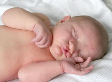Cleft and lip palate newborn baby