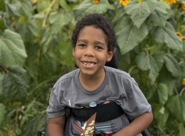 Patient family submitted photos for Adonis