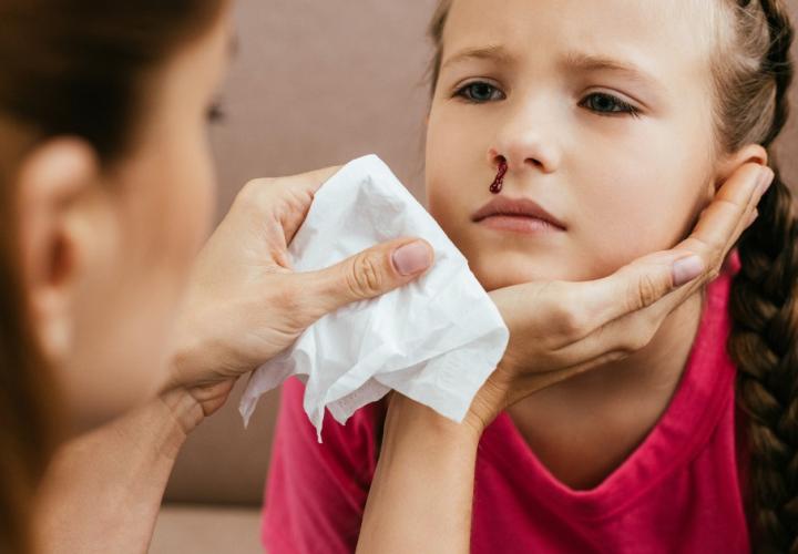 Ask an ENT: Nosebleeds in Kids | Connecticut Children's