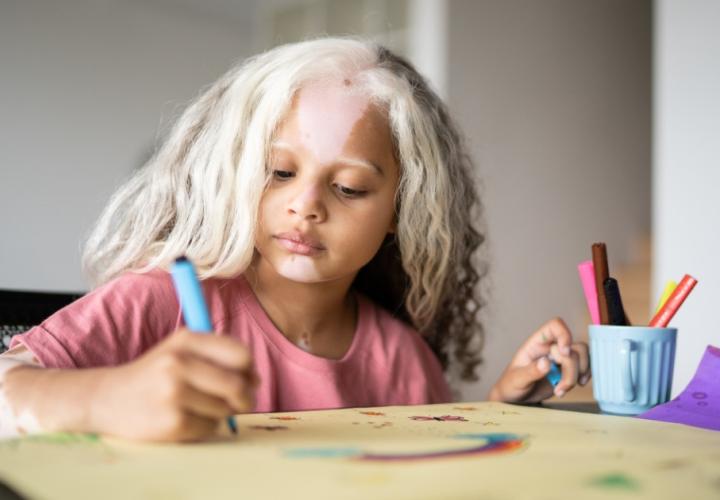 Girl with piebaldism drawing