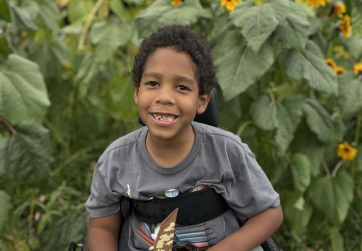 Patient family submitted photos for Adonis