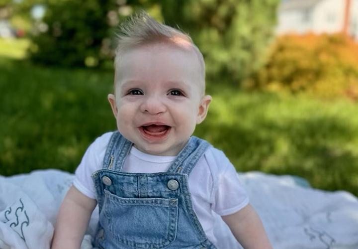 Craniofacial patient Tatum