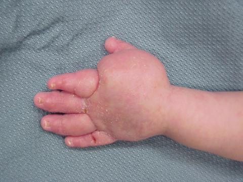 An infant hand