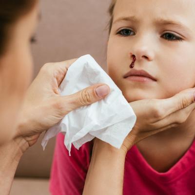 A young girl with a nose bleed