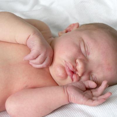 Cleft and lip palate newborn baby