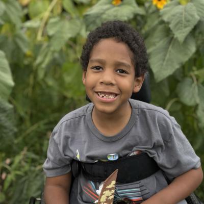 Patient family submitted photos for Adonis