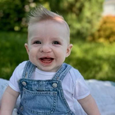 Craniofacial patient Tatum