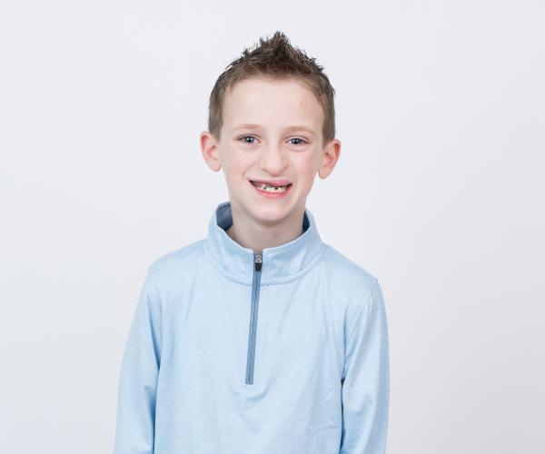 A craniofacial patient with a big smile.